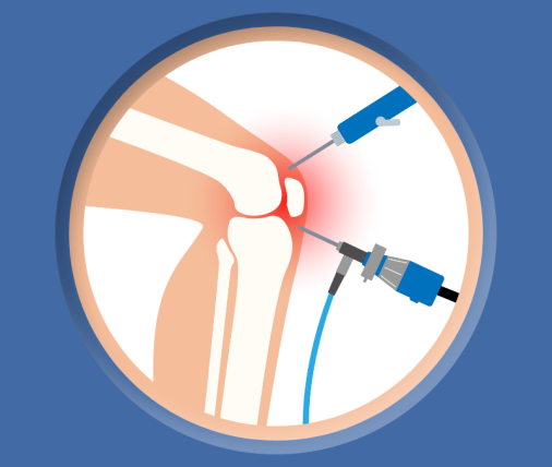 artroskopia-kolana-fizjokinetic.com